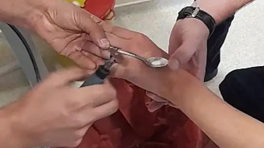 Elazığ'da itfaiyeden yüzük çıkarma operasyonu