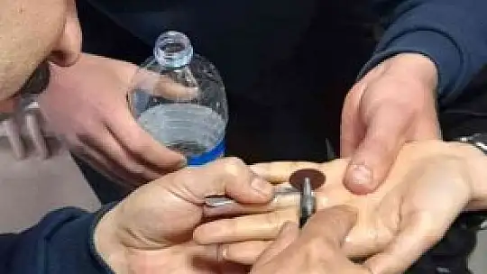 Parmağa sıkışan yüzüğü itfaiye ekipleri çıkardı