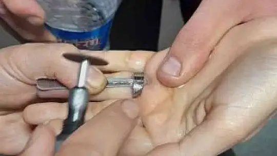 Parmağa sıkışan yüzüğü itfaiye ekipleri çıkardı