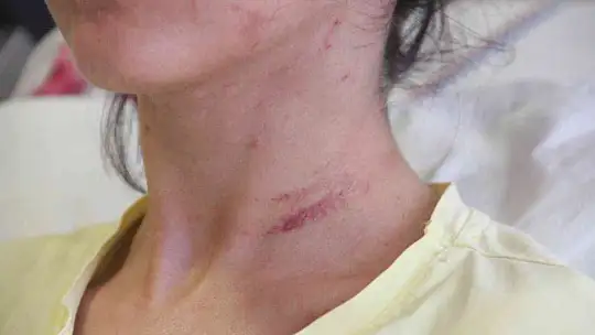 Sevgilisini 2 saat boyunca darp edip 5 yerinden bıçaklayan doktorun 20 yıla kadar hapsi istendi