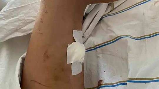 Sevgilisini 2 saat boyunca darp edip 5 yerinden bıçaklayan doktorun 20 yıla kadar hapsi istendi