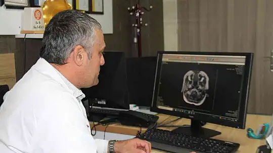 Uzm Dr. Kapan: 'MS hastalığı erkeklere oranla kadınlarda 2 kat daha fazla görülür'