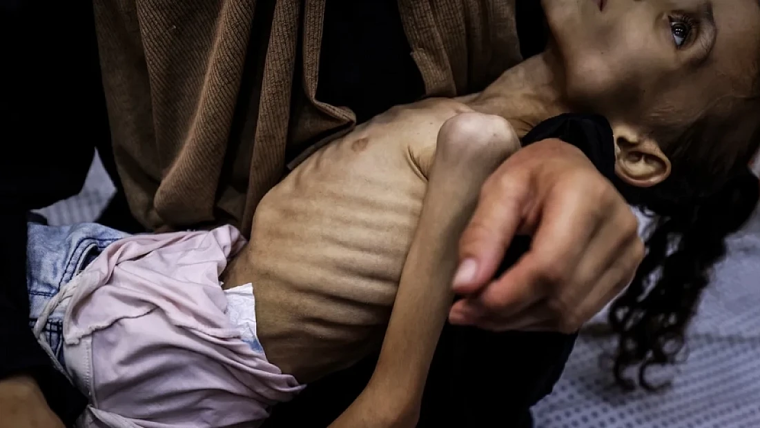 Gazze'de açlıktan ölenlerin sayısı artıyor