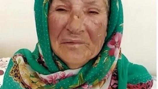 Mutfak Tüpünden Sızan Gaz Bomba Gibi Patladı