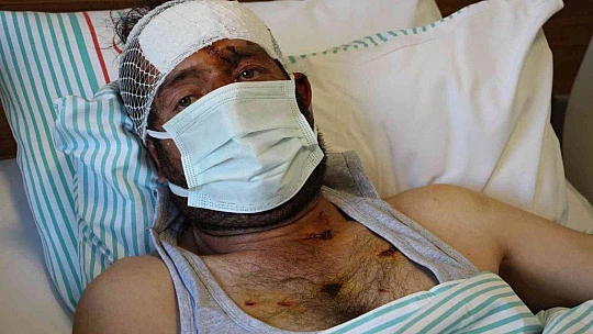 Ayı saldırısı sonucu hastanelik olan şahıs, dehşet anlarını anlattı: 'O korkuyla 5 kilometre yol yürümüşüm'