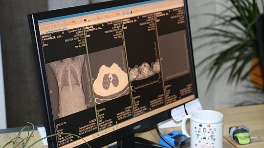 Covid'i yenen doktor 5 gününü hatırlamıyor