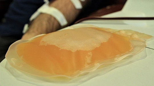 Doktor Covid-19 geçirenlere seslendi: 'Yalvarıyorum bağışçı olun'