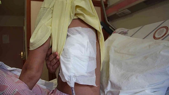 Doktor sevgilisinin evinde dehşeti yaşayan genç kadın 2 saat boyunca darp edildi, 5 yerinden bıçaklandı