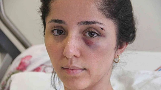 Doktor sevgilisinin evinde dehşeti yaşayan genç kadın 2 saat boyunca darp edildi, 5 yerinden bıçaklandı