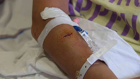 Doktor sevgilisinin evinde dehşeti yaşayan genç kadın 2 saat boyunca darp edildi, 5 yerinden bıçaklandı