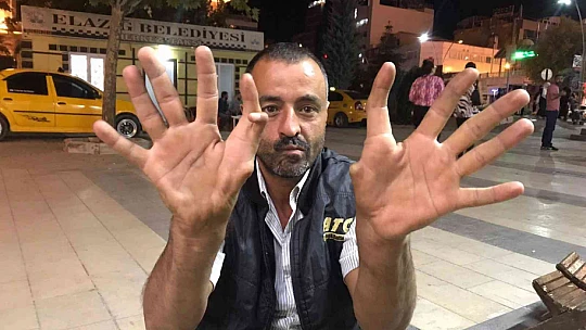 Elazığ'da 11 parmaklı adam görenleri hayrete düşürüyor