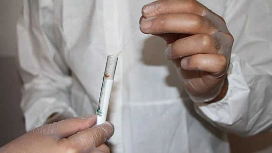 Elazığ'da 235 filyasyon ekibi  Covid-19'la mücadele ediyor