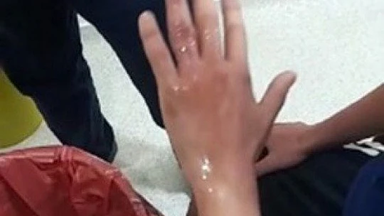 Elazığ'da itfaiyeden yüzük çıkarma operasyonu