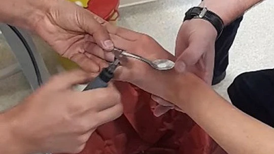 Elazığ'da itfaiyeden yüzük çıkarma operasyonu