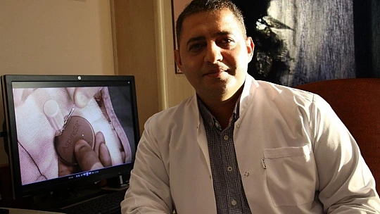 Epilepsi pili operasyonu sara hastalarının umudu oldu