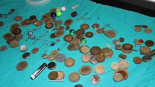 Para, pul, iğne, yüzük: Bu midelerde ne ararsanız var