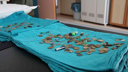 Para, pul, iğne, yüzük: Bu midelerde ne ararsanız var