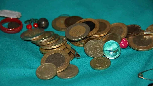 Para, pul, iğne, yüzük: Bu midelerde ne ararsanız var