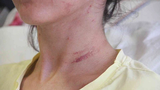 Sevgilisini 2 saat boyunca darp edip 5 yerinden bıçaklayan doktorun 20 yıla kadar hapsi istendi