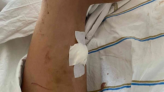 Sevgilisini 2 saat boyunca darp edip 5 yerinden bıçaklayan doktorun 20 yıla kadar hapsi istendi