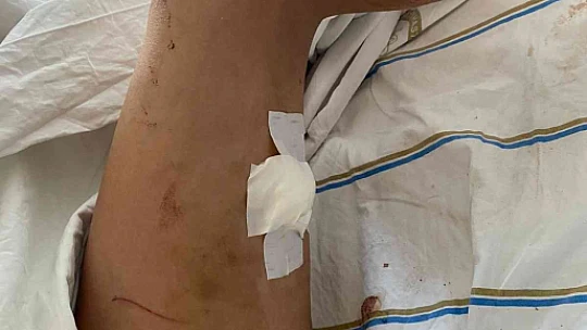 Sevgilisini darp edip 5 yerinden bıçaklamıştı, ilk duruşmada kendini savundu