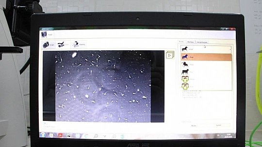 Türkiye'de sperm numunelerini 3 farklı kategoride analiz eden sistem geliştirdi