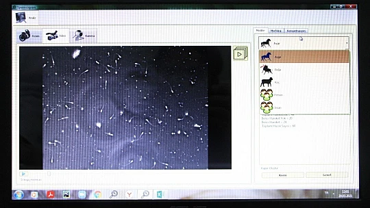 Türkiye'de sperm numunelerini 3 farklı kategoride analiz eden sistem geliştirdi