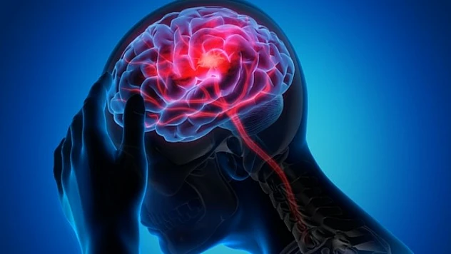 Prof. Dr. Demir, beyin sisi hastalığı hakkında önemli açıklamalarda bulundu