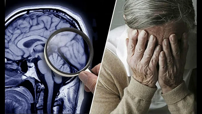 Fırat Üniversitesi Hastanesinden Demans ve Alzheimer uyarısı