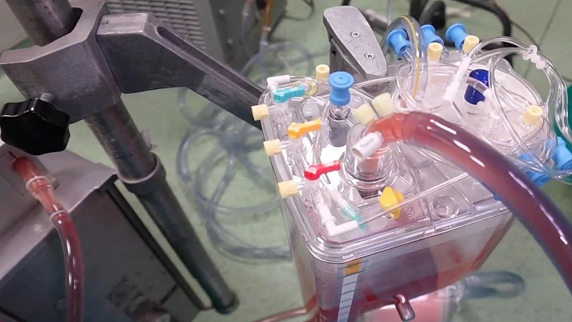 FÜ Hastanesinde HIPEC yöntemi ile kanser tedavisi uygulanıyor