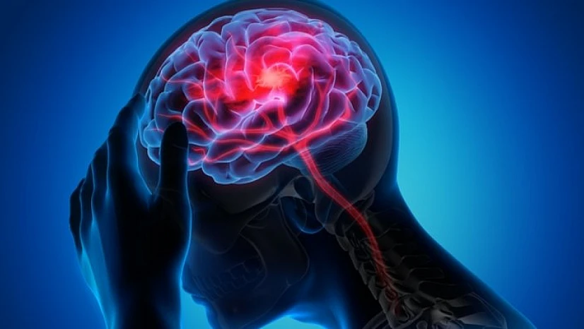 Prof. Dr. Demir, beyin sisi hastalığı hakkında önemli açıklamalarda bulundu